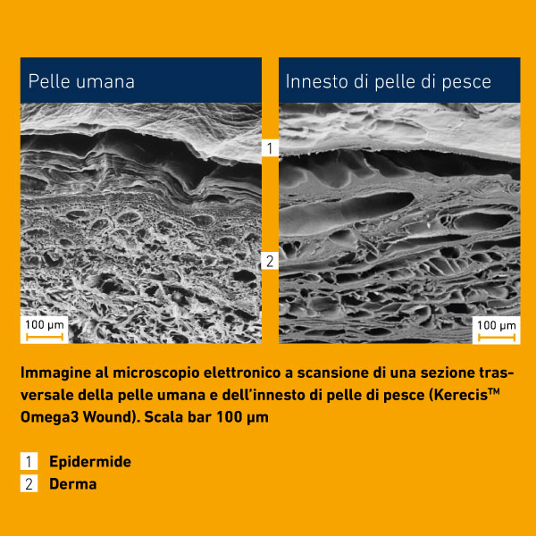 kerecis pelle